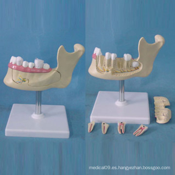 Modelo de la anatomía de la estructura del lugar del diente humano para la enseñanza (R080113)